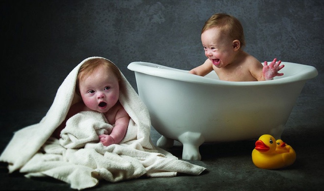 Down-szindrómás babák modellkednek